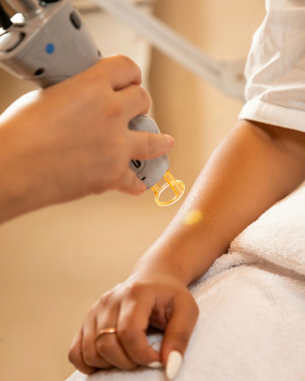 hair removal umeå
