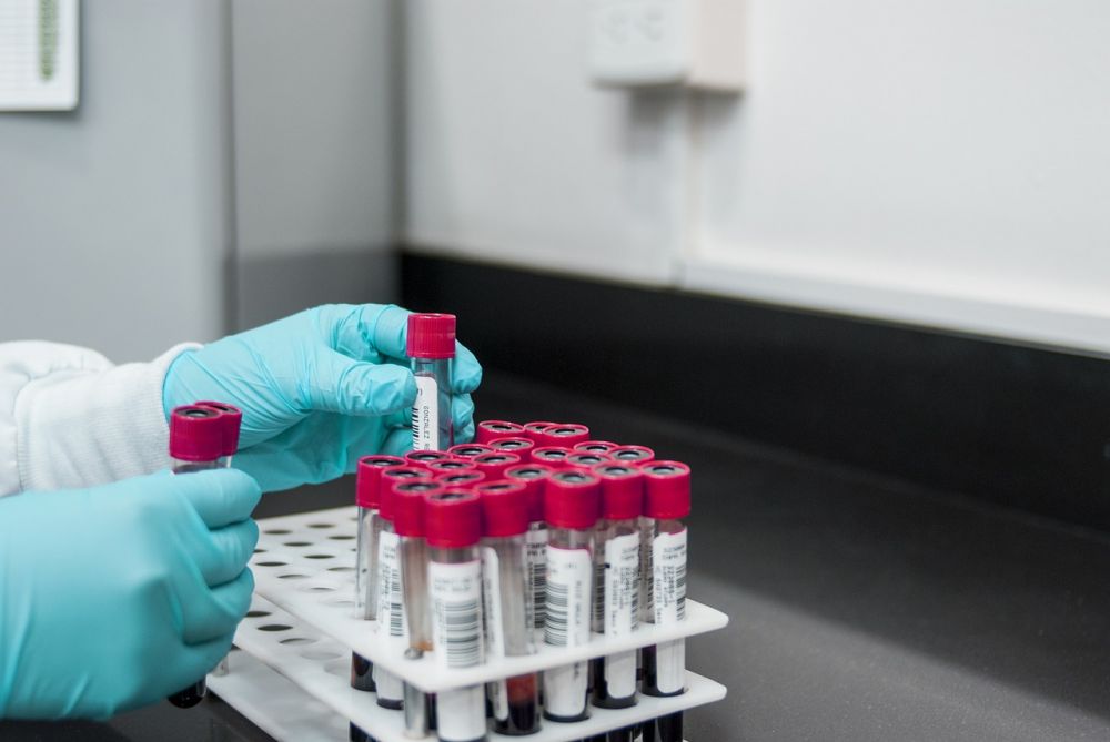 Listeria sampling