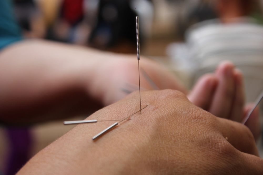 Acupuncture højbjerg