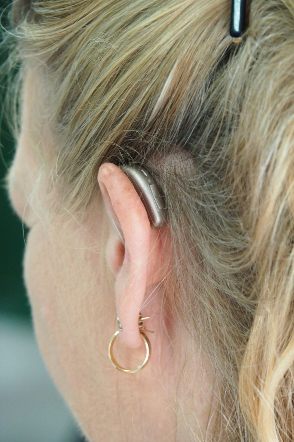 hearing care professional Malmö