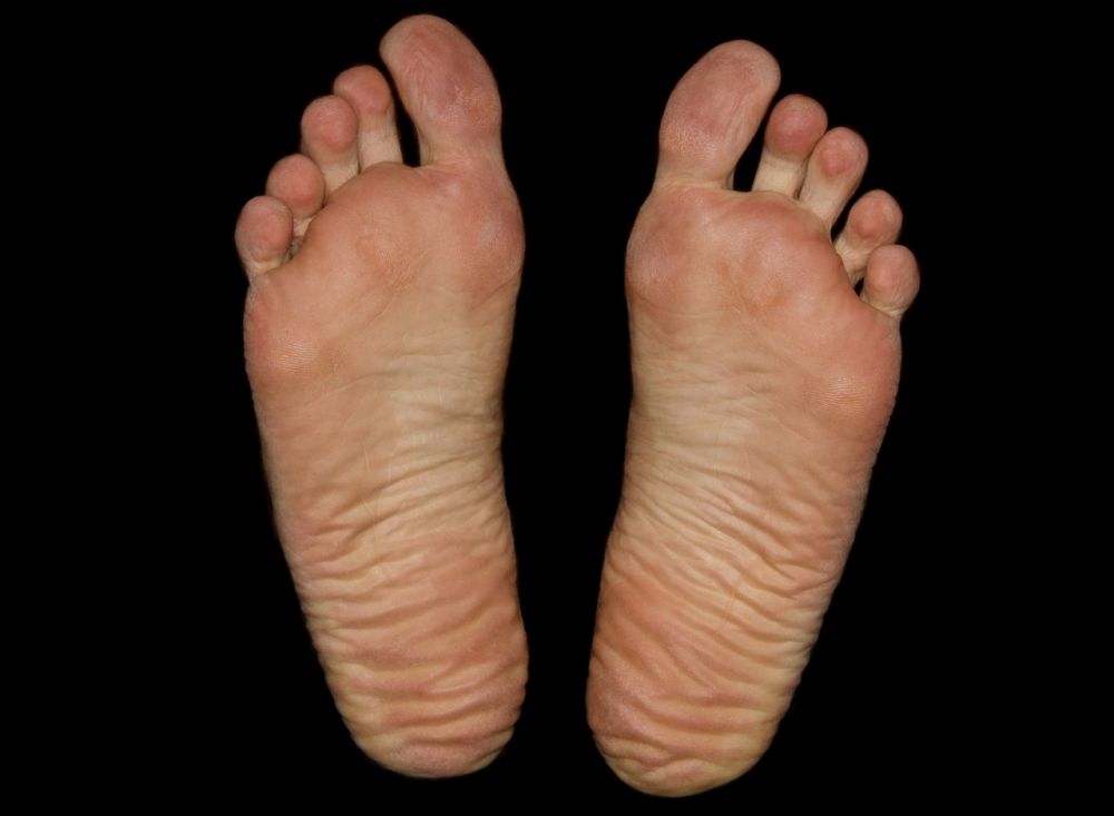 Foot specialist Helsingborg