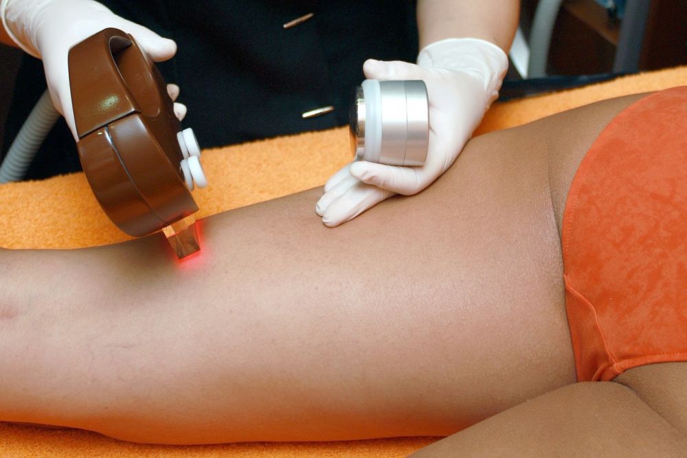 Laser hair removal