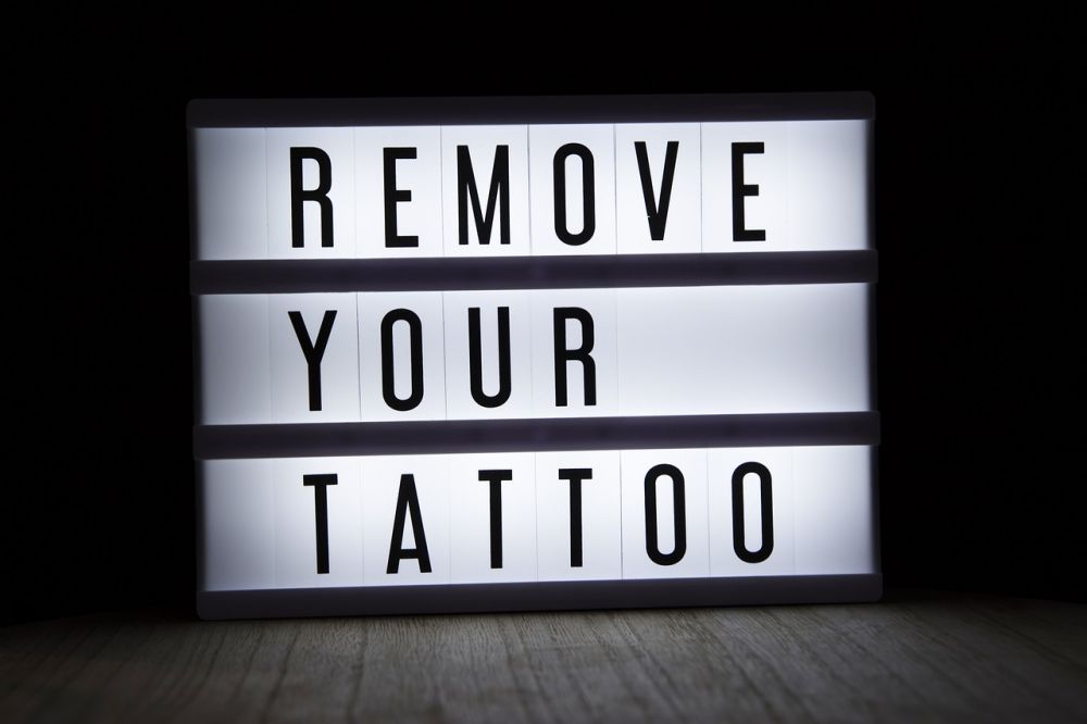 tattoo removal