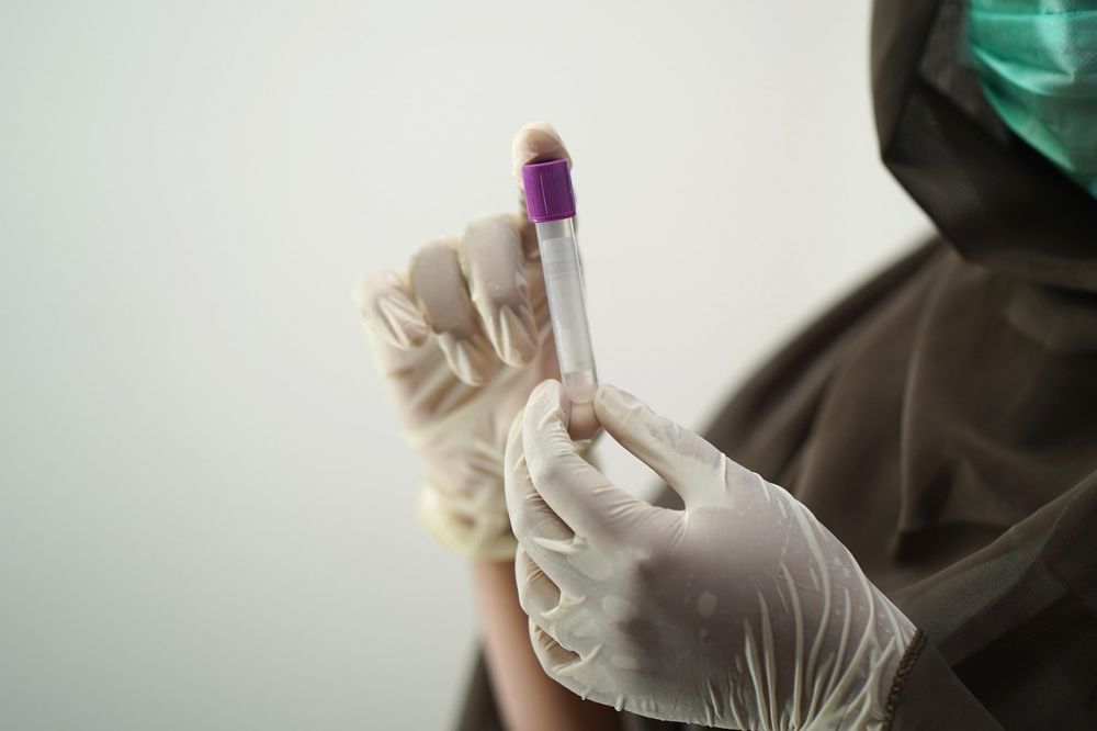 Blood tests Stockholm