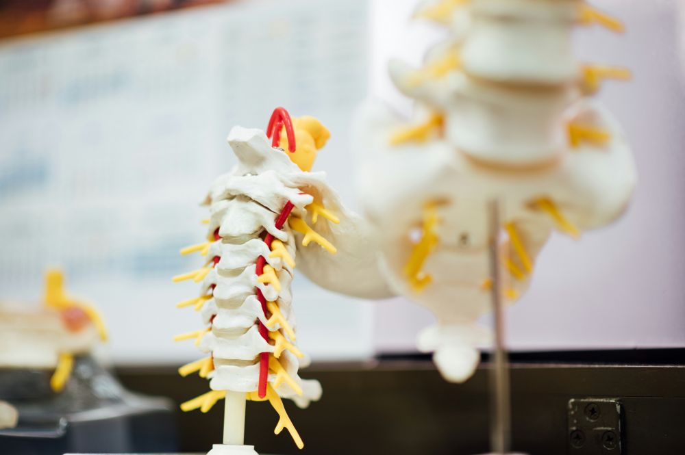 spinal stenosis