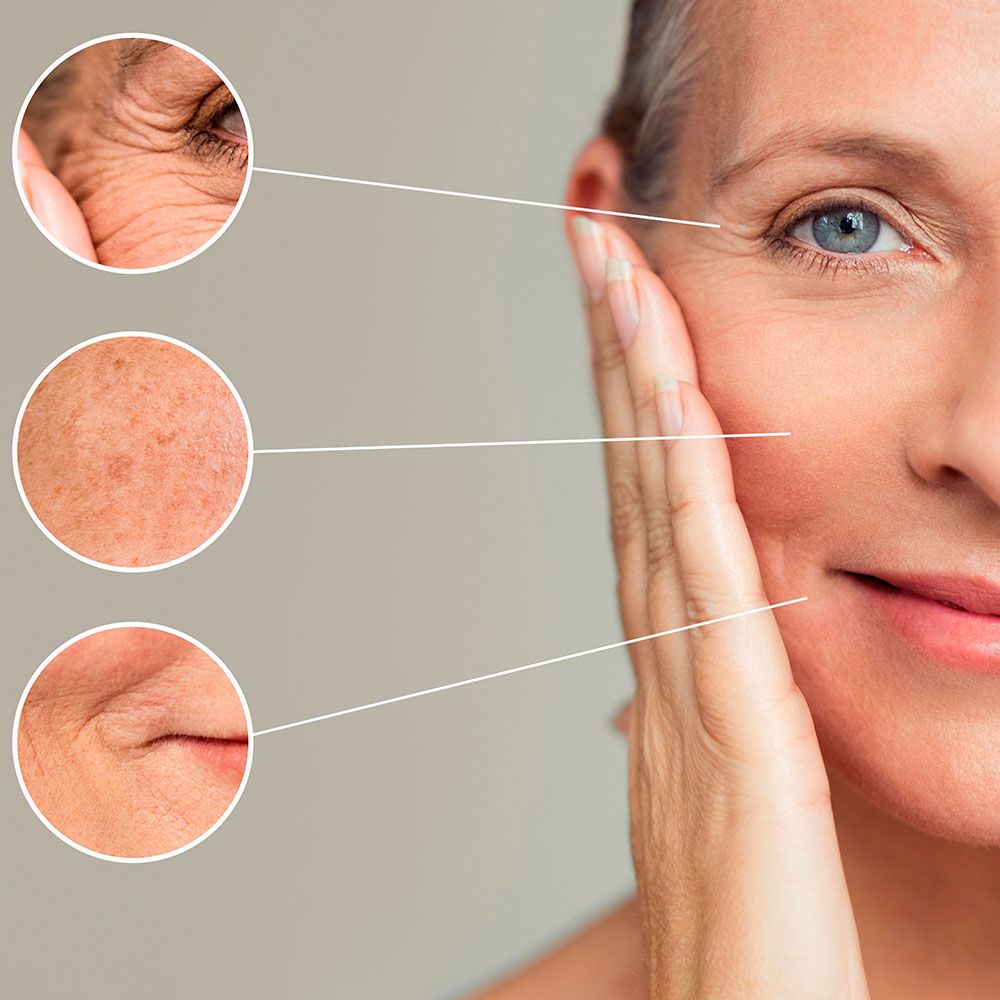 microneedling Hillerød