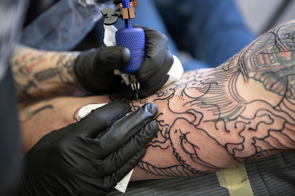 tattoo removal Uddevalla