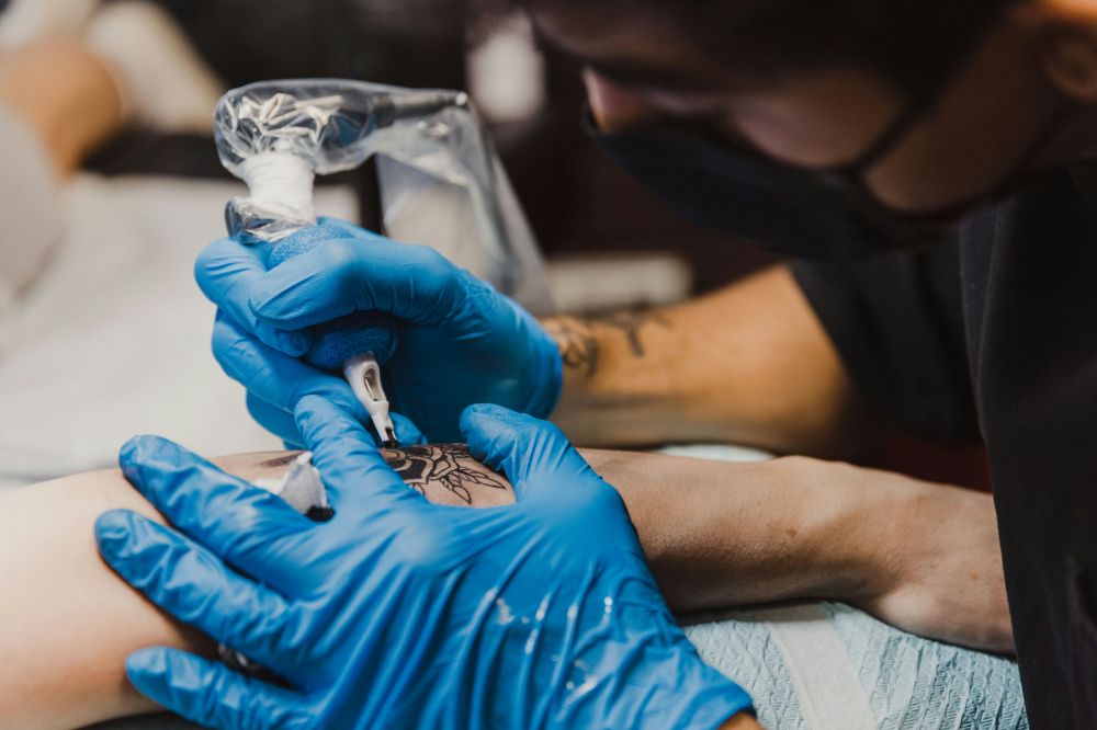 tattoo removal oslo