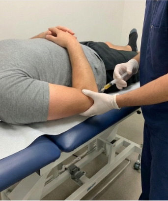 Knee osteoarthritis prp Stockholm