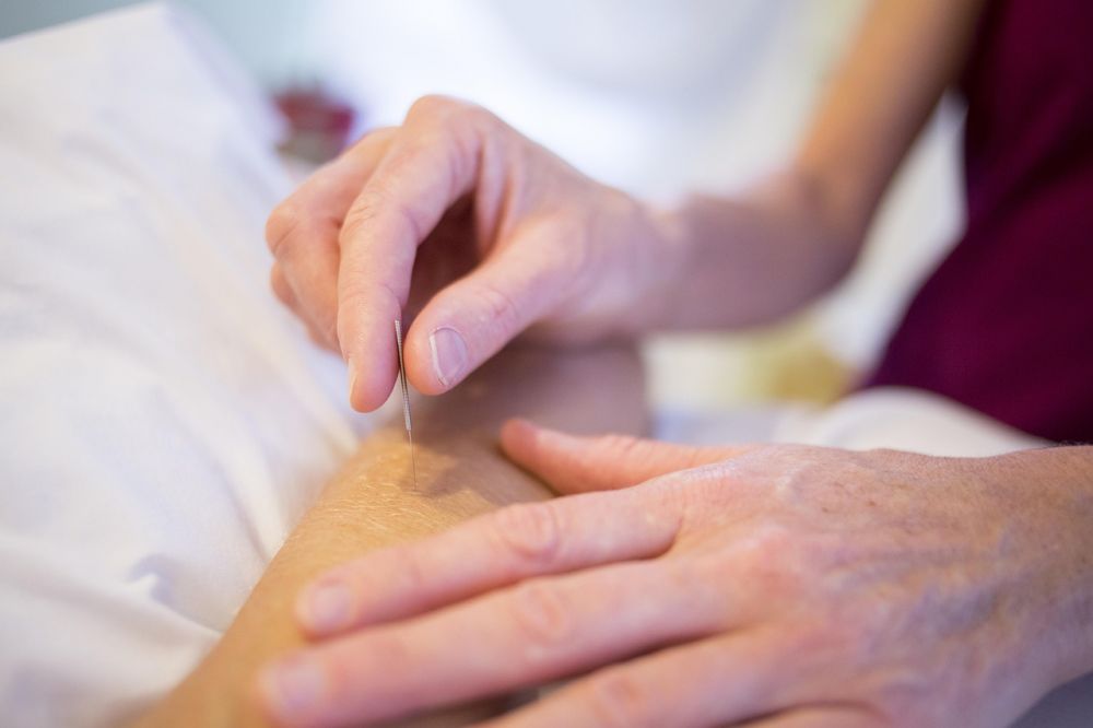 acupuncture herning