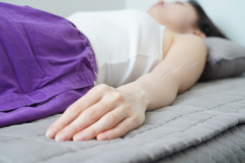 acupuncture silkborg