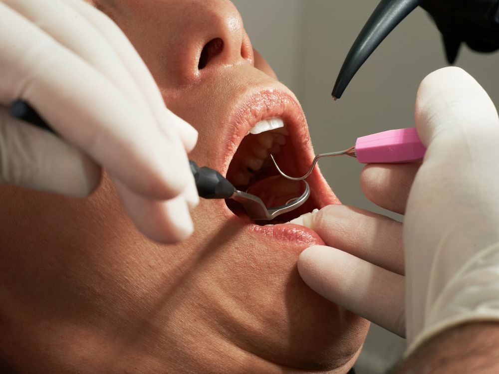 Tandlæge Frederikshavn