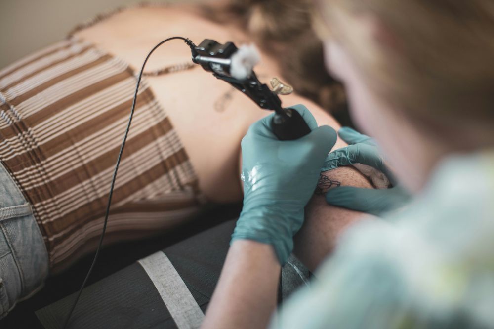 Fjernelse af tatovering